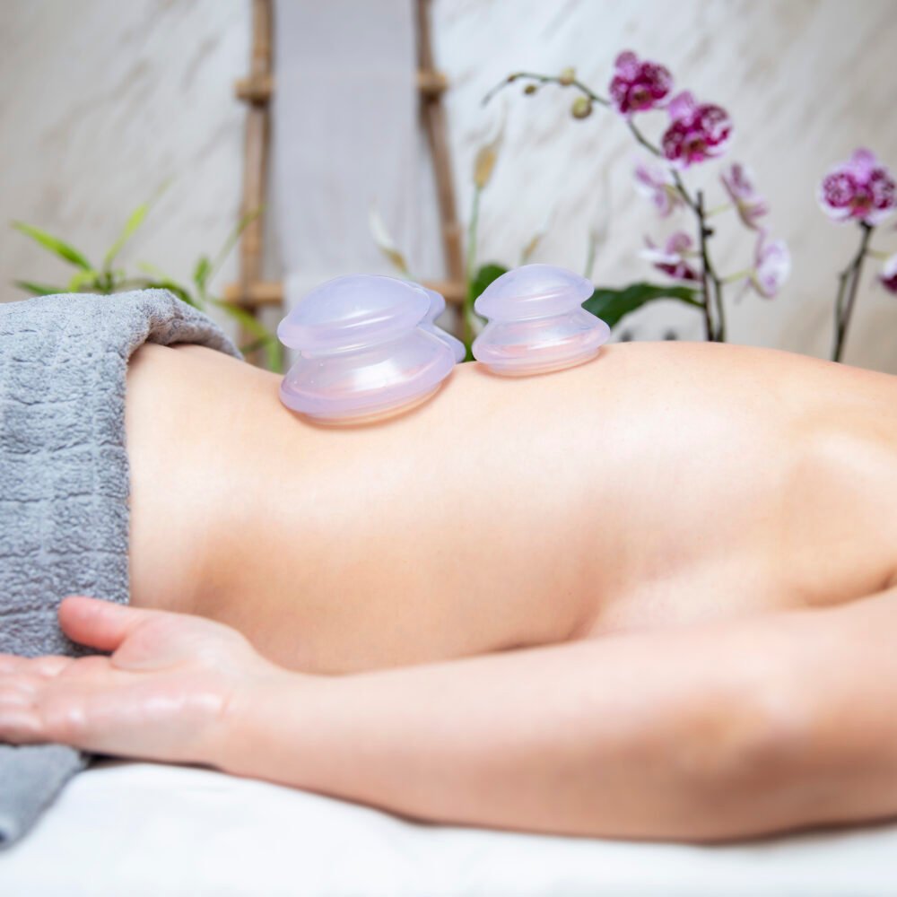 Cupping Massage image